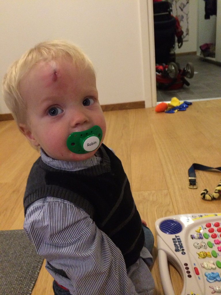 20131128-17-42-01.jpg - Möte med hårt element. Aj.